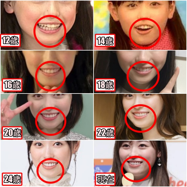 12歳から25歳の福原遥の顎（口）