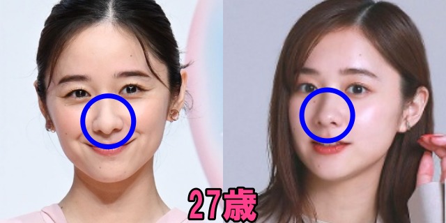 堀田真由の27歳の鼻の画像