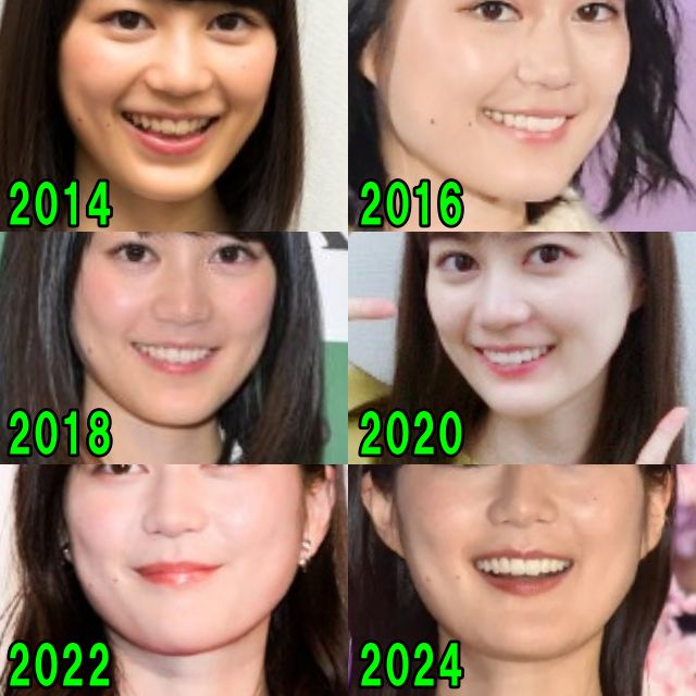 生田絵梨花の2014年から2024年のフェイスラインの比較画像