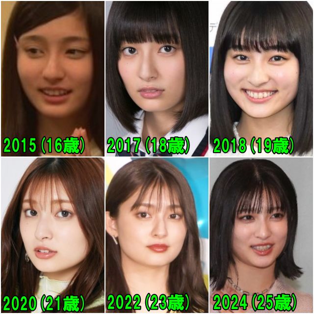 吉川愛の2015年から2024年の顎の画像