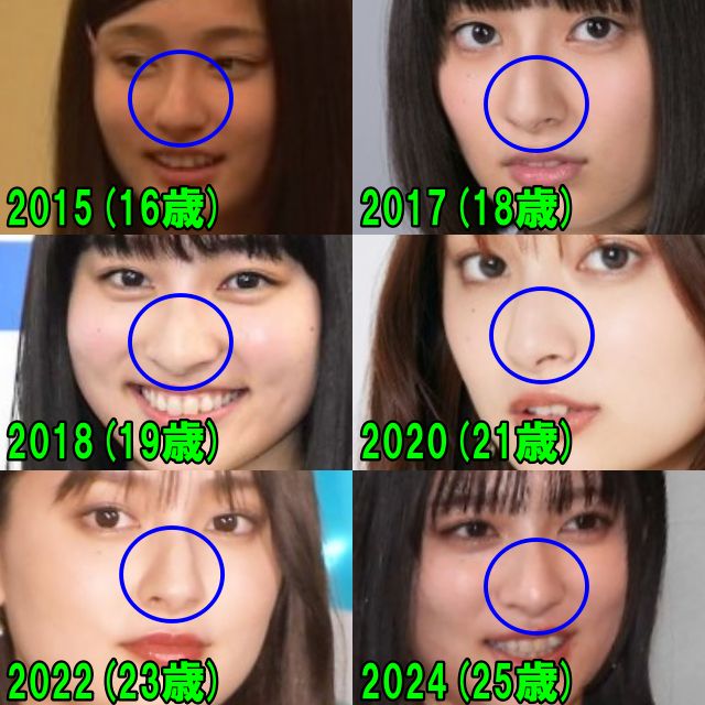 吉川愛の2015年から2024年の鼻の画像