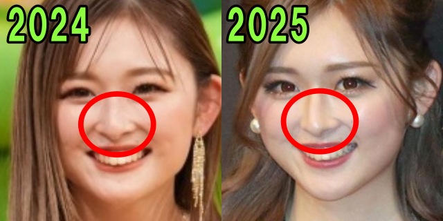 ゆうちゃみの2024年と2025年の鼻の画像