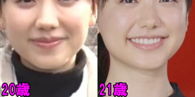 芦田愛菜の20歳・21歳の顎の画像