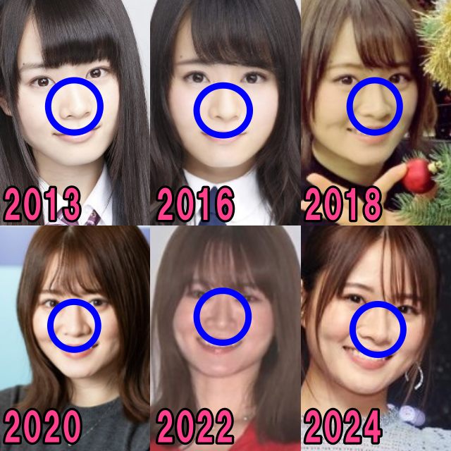 山崎怜奈の2013年から2024年の鼻の画像