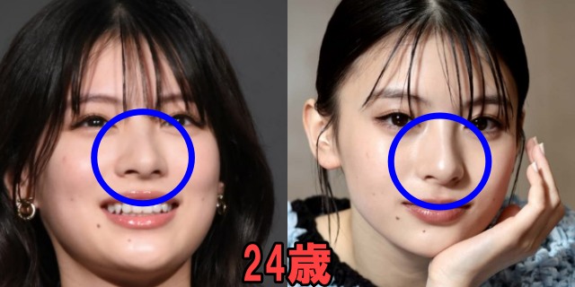 出口夏希の24歳の鼻の画像