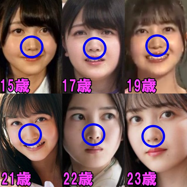 久保史緒里の15歳から23歳までの鼻の画像