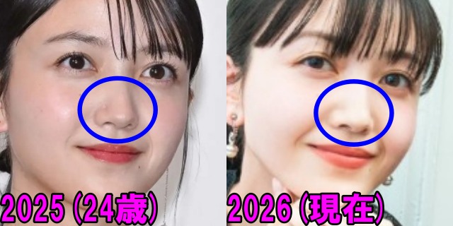 久保史緒里の2025年と2026年の鼻の画像