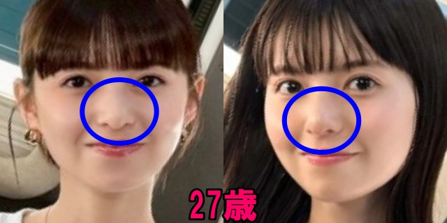 齋藤飛鳥の27歳の鼻の画像