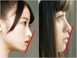 橋本環奈の整形疑惑を完全否定!顔や鼻の変化は本当か画像34枚から証拠を発見! | 仰天!芸能人・有名人の整形事情