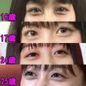 橋本環奈の整形疑惑を完全否定!顔や鼻の変化は本当か画像34枚から証拠を発見! | 仰天!芸能人・有名人の整形事情