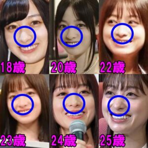 橋本環奈の整形疑惑を完全否定!顔や鼻の変化は本当か画像34枚から証拠を発見! | 仰天!芸能人・有名人の整形事情
