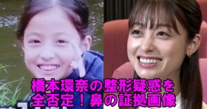 橋本環奈の整形疑惑を完全否定!顔や鼻の変化は本当か画像34枚から証拠を発見! | 仰天!芸能人・有名人の整形事情