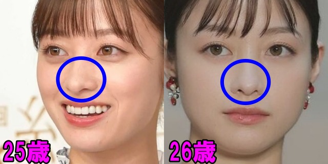 橋本環奈の25歳と26歳の鼻の画像