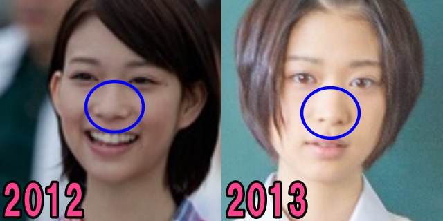 森川葵の2012年と2013年の鼻