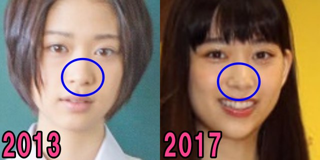 森川葵の2013年と2017年の鼻