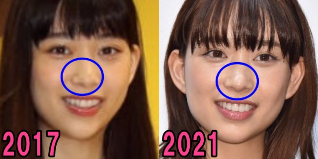 森川葵の2017年と2021年の鼻