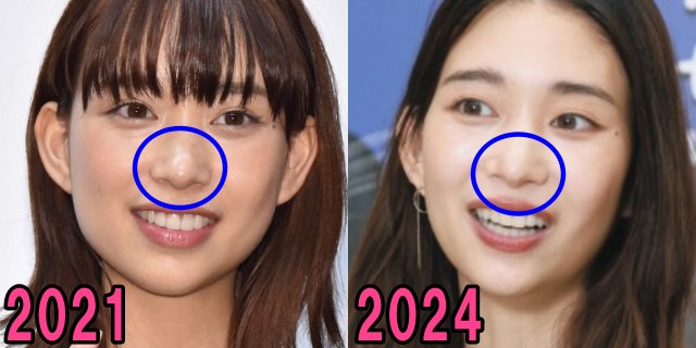 森川葵の2021年と2024年の鼻