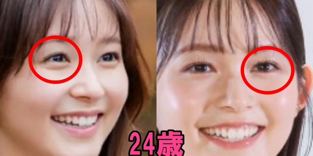 久間田琳加の24歳の目の画像