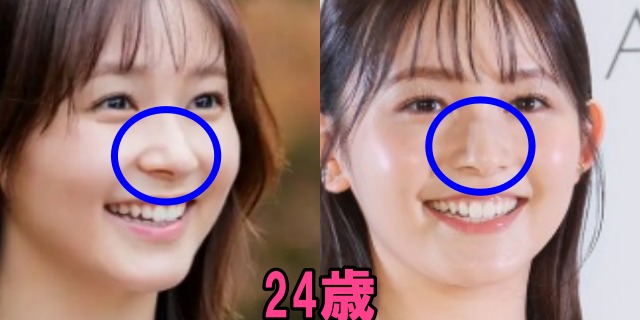 久間田琳加の24歳の鼻の画像