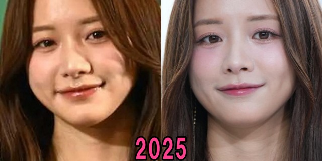 森香澄の2025年の唇の画像