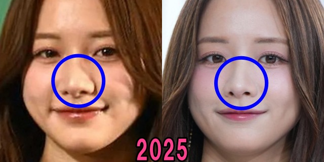 森香澄の2025年の鼻の画像