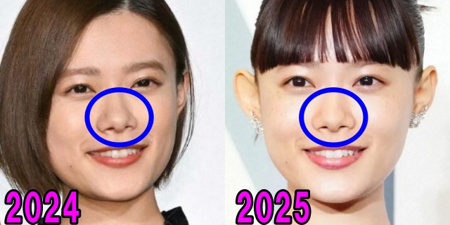 杉咲花の2024年と2025年の鼻の画像