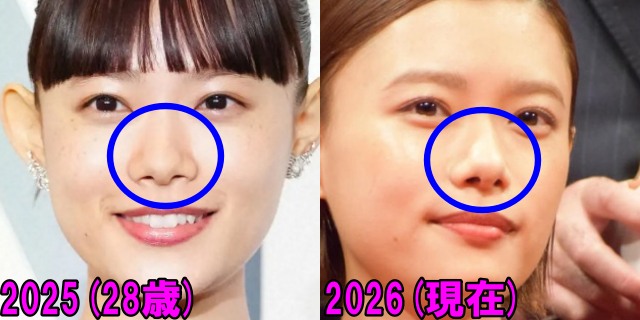 杉咲花の2025年と2026年の鼻の画像