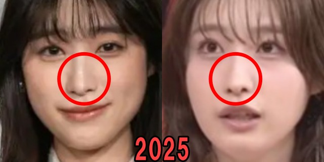 高橋ひかるの2025年の鼻の画像