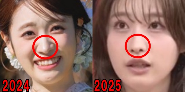 高橋ひかるの2024年と2025年の鼻の画像