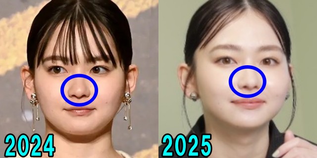 山田杏奈の2024年と2025年の鼻の画像