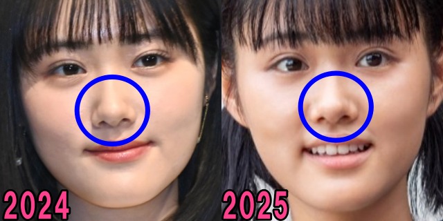 原菜乃華の2024年と2025年の鼻の画像