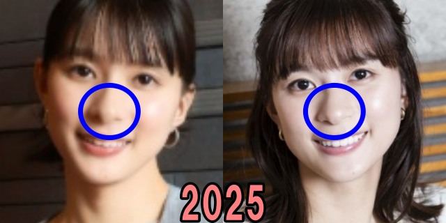 芳根京子の2025年の鼻の画像
