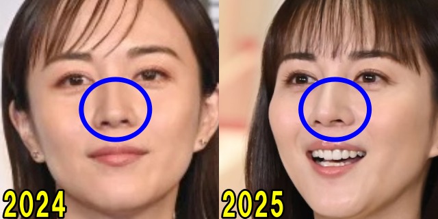 比嘉愛未の2024年と2025年の鼻の画像