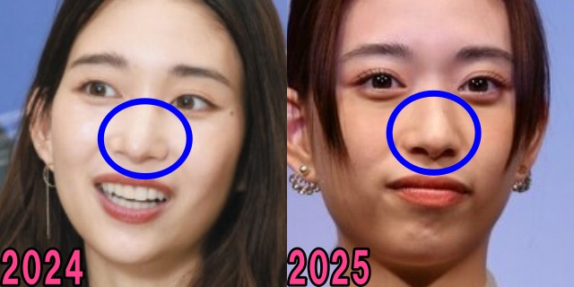 森川葵の2024年と2025年の鼻の画像