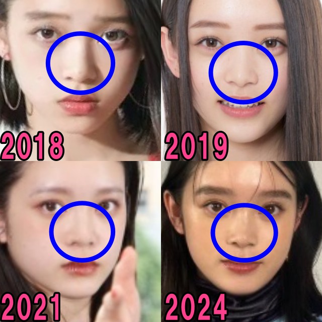 高石あかりの2018年から2024年の鼻の画像