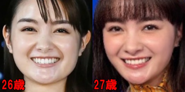 葵わかなの26歳と27歳の口の画像