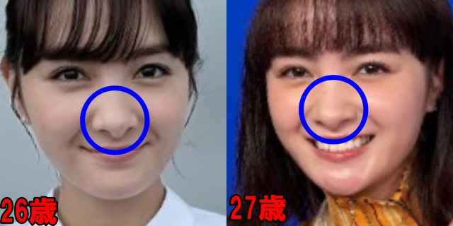 葵わかなの26歳と27歳の鼻の画像