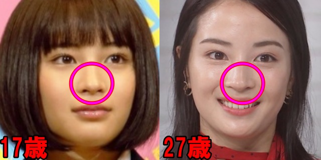 広瀬すずの17歳と27歳の鼻の画像
