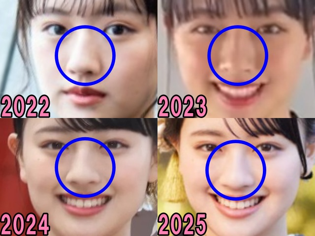 上坂樹里の2022年から2025年の鼻の画像