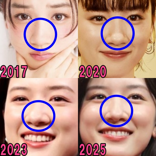 永野芽郁の2017年から2025年の鼻の画像
