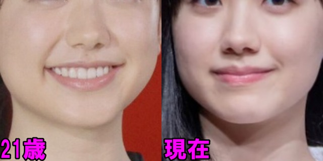 芦田愛菜の21歳と現在の顎の画像