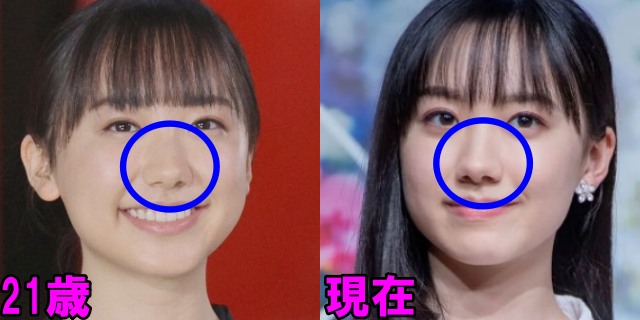芦田愛菜の21歳と現在の鼻の画像