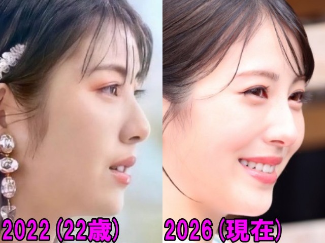 浜辺美波の2022年と2026年の横顔