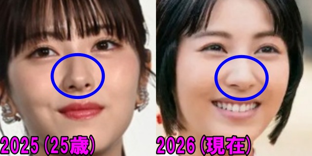 浜辺美波の2025年と2026年の鼻の画像