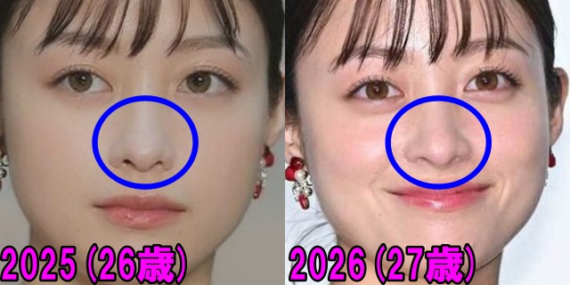 橋本環奈の2025年と2026年の鼻の画像