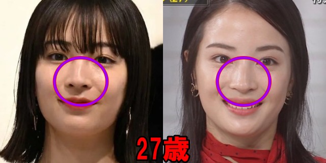 広瀬すずの27歳の鼻の画像