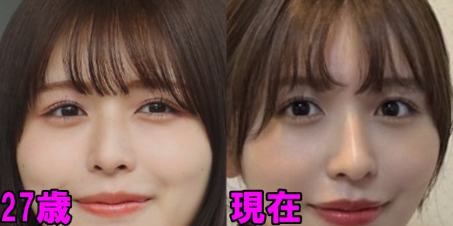 長濱ねるの27歳と現在の目の画像