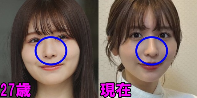 長濱ねるの27歳と現在の鼻の画像