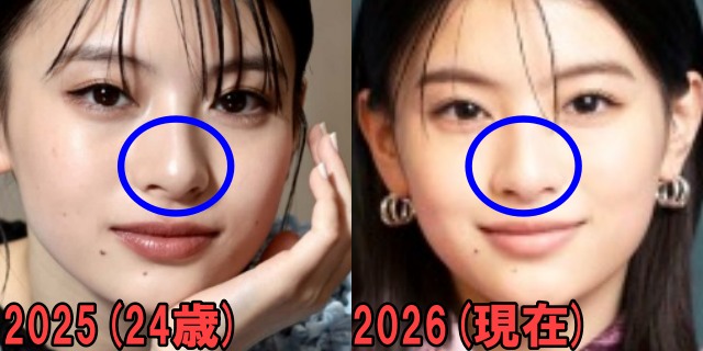 出口夏希の2025年と2026年の鼻の画像