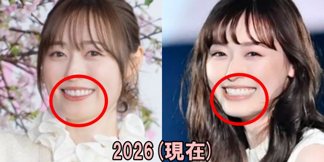 福原遥の2026年の顎の画像